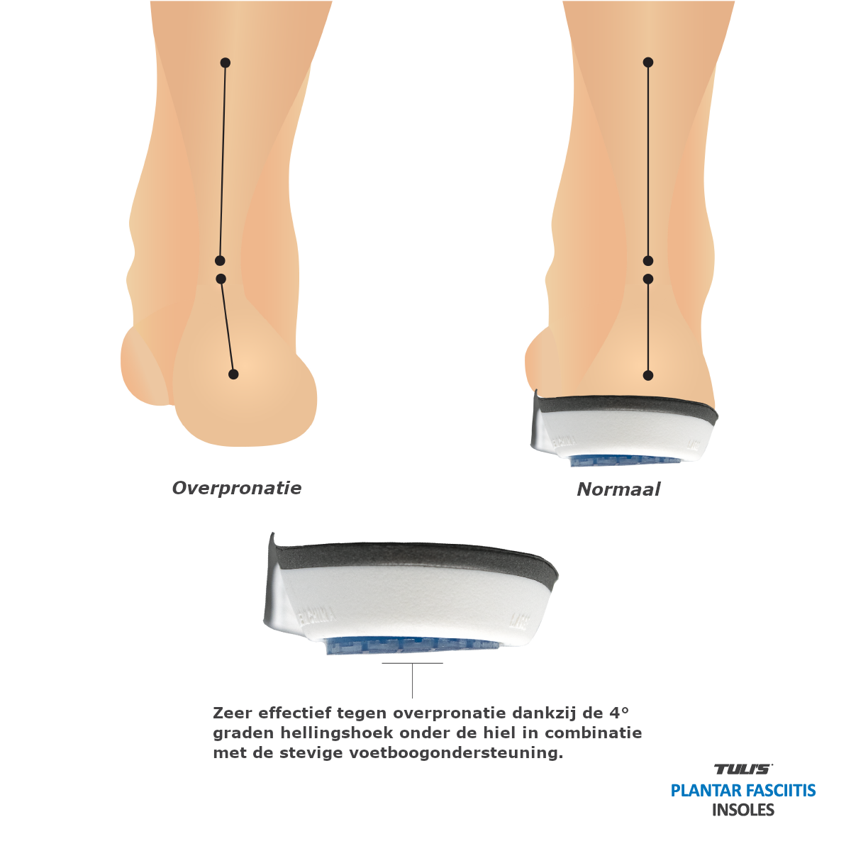 Tuli's Peesplaatontsteking steunzolen / Plantar Fascia