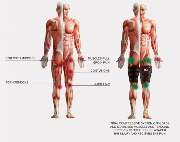 Reh4Sport Dijbeenbrace / bovenbeenbrace