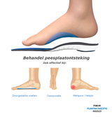 Tuli's Peesplaatontsteking steunzolen / Plantar Fascia